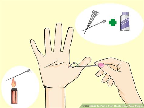 Image result for String Pull Method Fish Hook Removal