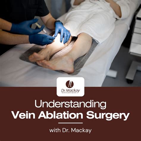 Vein Ablation Surgery Guide for Patients by Dr. Mackay