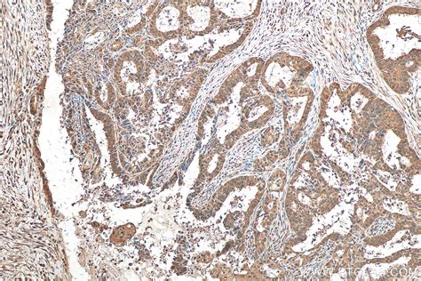 Hsc70 antibody (10654-1-AP) | Proteintech