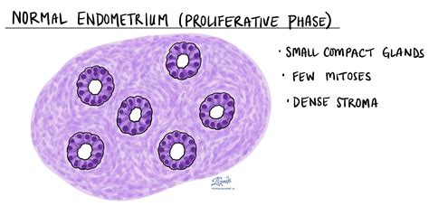Ihr Pathologiebericht zur atypischen Endometriumhyperplasie ...