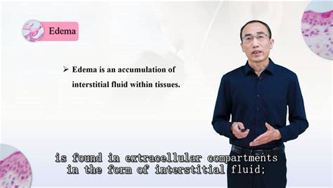 医学 的图像结果