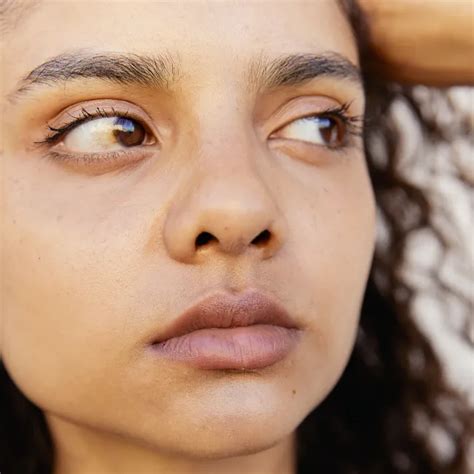 Are Indian Women More Prone To Dark Circles? We Investigate