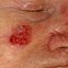 Image result for Skin Diseases and Conditions