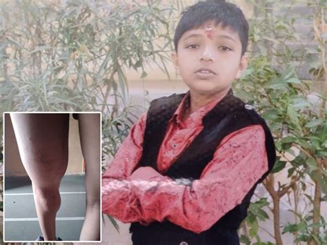 Doctors do not have a cure for a child suffering from a disease called ...