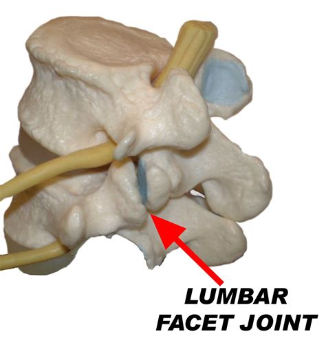 Facet Joints Anatomy Facet Joint Syndrome Centeno Schultz Clinic