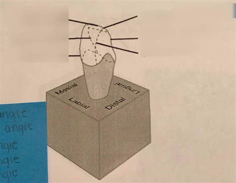 Line Angle Teeth 的图像结果