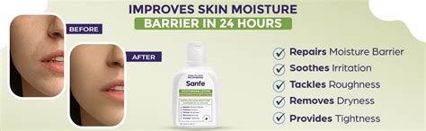Buy Sanfe Moisturising Lotion | Improves skin moisture barrier in 24 ...