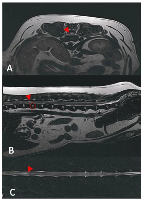 A Comparative Analysis of Clinical Presentation, Prognosis and Outcomes ...