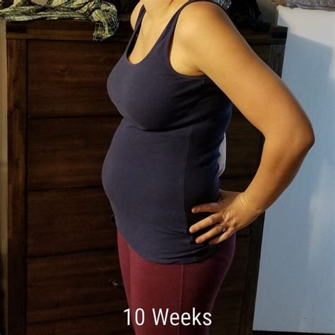 10 Weeks Pregnant with Twins: Tips, Advice & How to Prep | Twiniversity #1 Parenting Twins Site