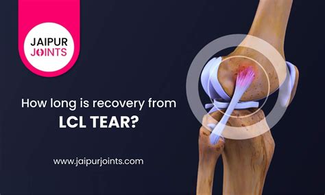 How long is Recovery from an LCL Tear in 2022 | LCL Treatment in Jaipur