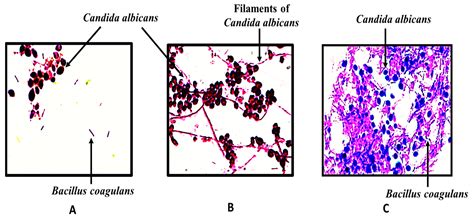 Preclinical Potential of Probiotic-Loaded Novel Gelatin–Oil Vaginal ...