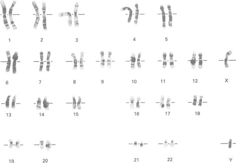 Image result for Abstract Methods of Collection Framework