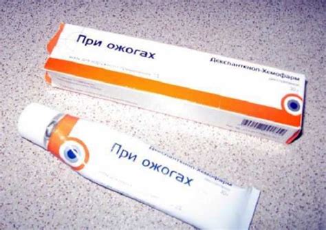 Эффективная мазь после ожога кипятком или другими раскаленными ...