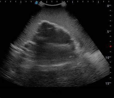Anatomy Lab Knee Arthrocentesis Ultrasound Training Model | Desertcart ...