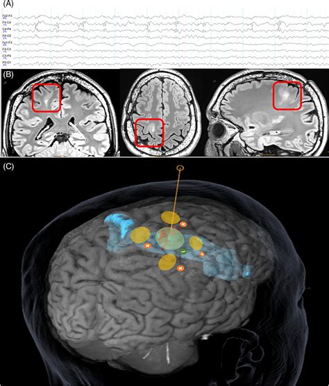 Image result for fMRI Python