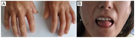 Pathophysiology | An Open Access Journal from MDPI