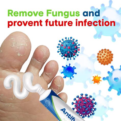 CHARMPOO Antifungal Cream Athletes Foot: Antifungal Cream for India | Ubuy