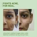 Plum Green Tea Pore Cleanser For Oily, Acne-Prone Skin | Fights Pimples ...