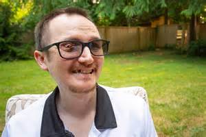 Image result for Tooth Eye Connection