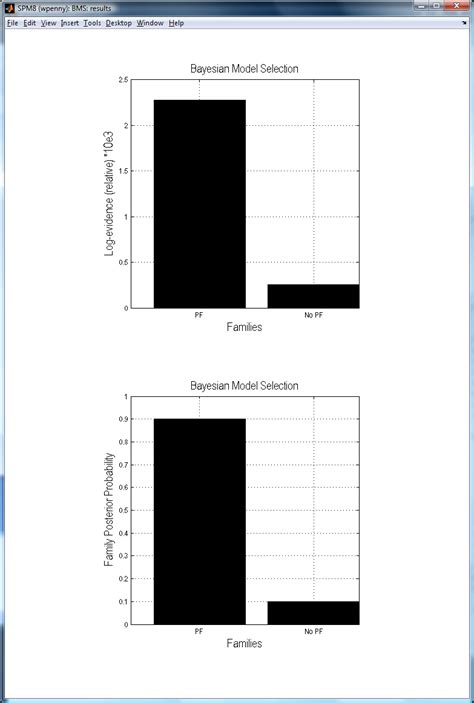 Statistical Parametric Mapping 的图像结果