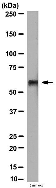 Anti-MT1-MMP Antibody, hemopexin domain | AB6070