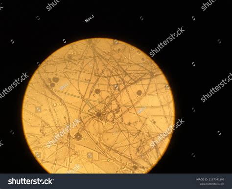 Fungi Under Microscopes Many Mycelium Stock Photo 2187341305 | Shutterstock