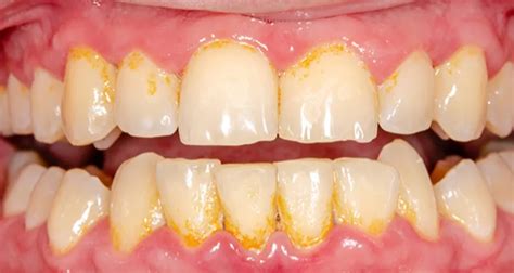 This Type of Cheese Is Great For Your Teeth, According to Dentists Background Aesthetic PNG