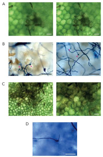 Transcriptome Analysis of Potato Infected with the Necrotrophic ...