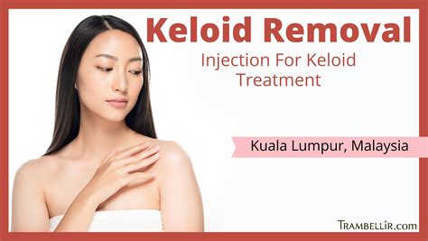 Keloid Scar Treatment Malaysia at Erin Birks blog