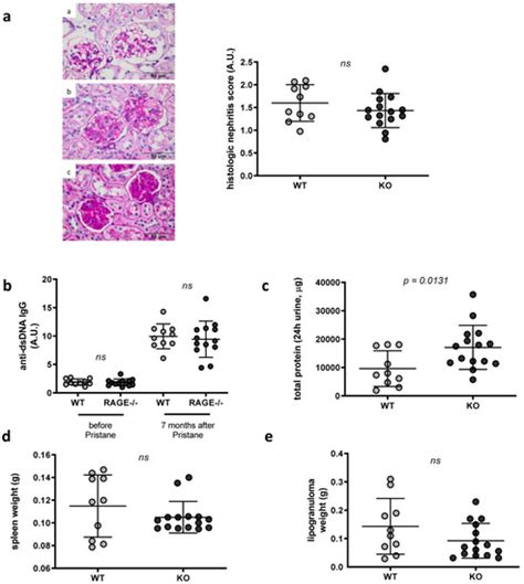 Relevance of Receptor for Advanced Glycation end Products (RAGE) in ...