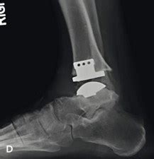Hardware Monitor Driver 的图像结果