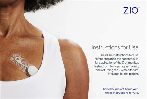 Zio® monitor Patient Education | iRhythm