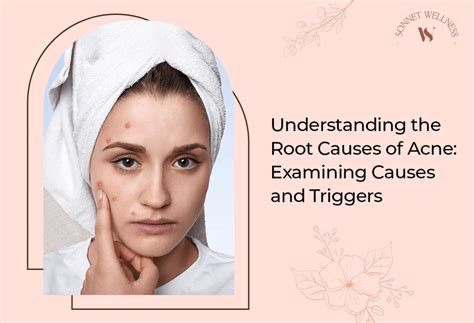 Understanding the Root Causes of Acne: Examining Causes and Triggers ...