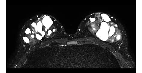 Philips Ingenia Ambition S