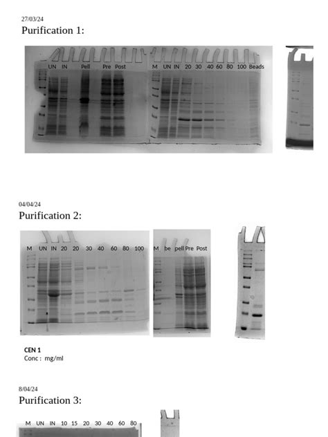 Image result for Basic Principles of Protein Purification