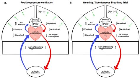 Difficult Respiratory Weaning after Cardiac Surgery: A Narrative Review