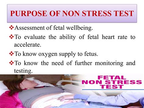 Non stress test | PPTX