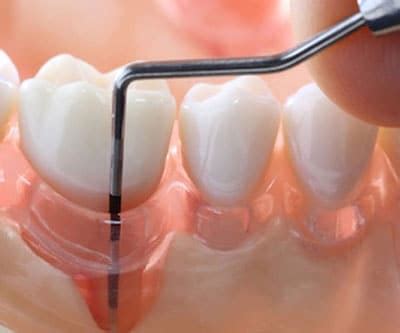 Fortino Dental - Best Dental Clinic in Delhi