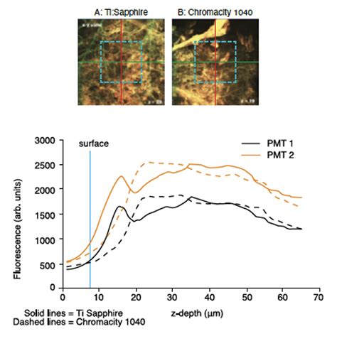 Cardiac Imaging using the Chromacity 1040 | Edmund Optics