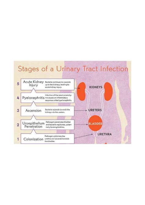 Stages of UTI - Nursing - Stages of a Urinary Tract Infection Acute Kidney Bacteria continues to ...