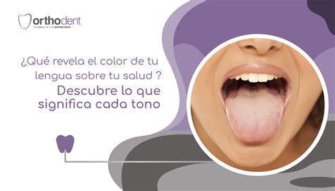 ¿Qué revela el color de tu lengua sobre tu salud? Descubre lo que ...