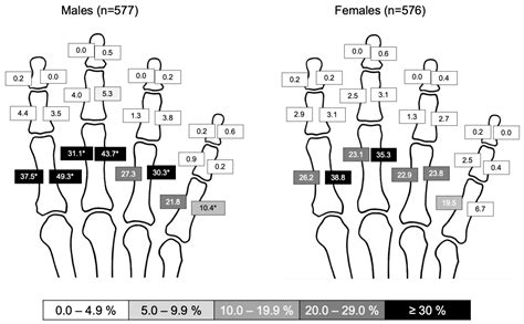 Osteo-Proliferative Lesions of the Phalanges on Radiography ...