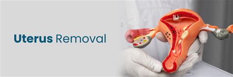 Uterus Removal (Hysterectomy): Reasons, Types & Recovery