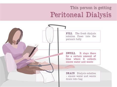 Peritoneal Dialysis Catheter Types