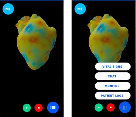 Image result for React Native ECG Graph