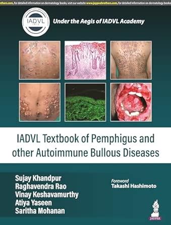 Buy IADVL TEXTBOOK OF PEMPHIGUS AND OTHER AUTOIMMUNE BULLOUS DISEASES ...