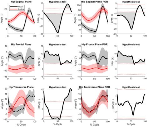 Comparison of Lower Limb Kinematics Between Increased Hip Flexion Gait ...