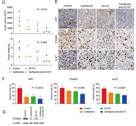 FOXM1 Is a Novel Molecular Target of AFP-Positive Hepatocellular ...