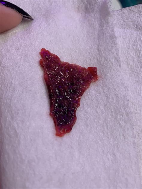 29/F is this a decidual cast? : r/medical