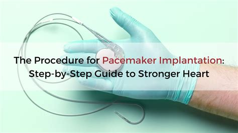Image result for Installing Pacemaker